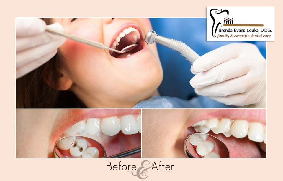 Brenda Evans Louka DDS (San Bernardino, CA) Picture 8