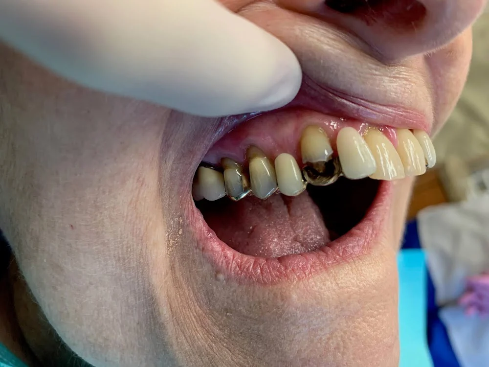 Virginia Family Dentistry Mechanicsville Picture 6