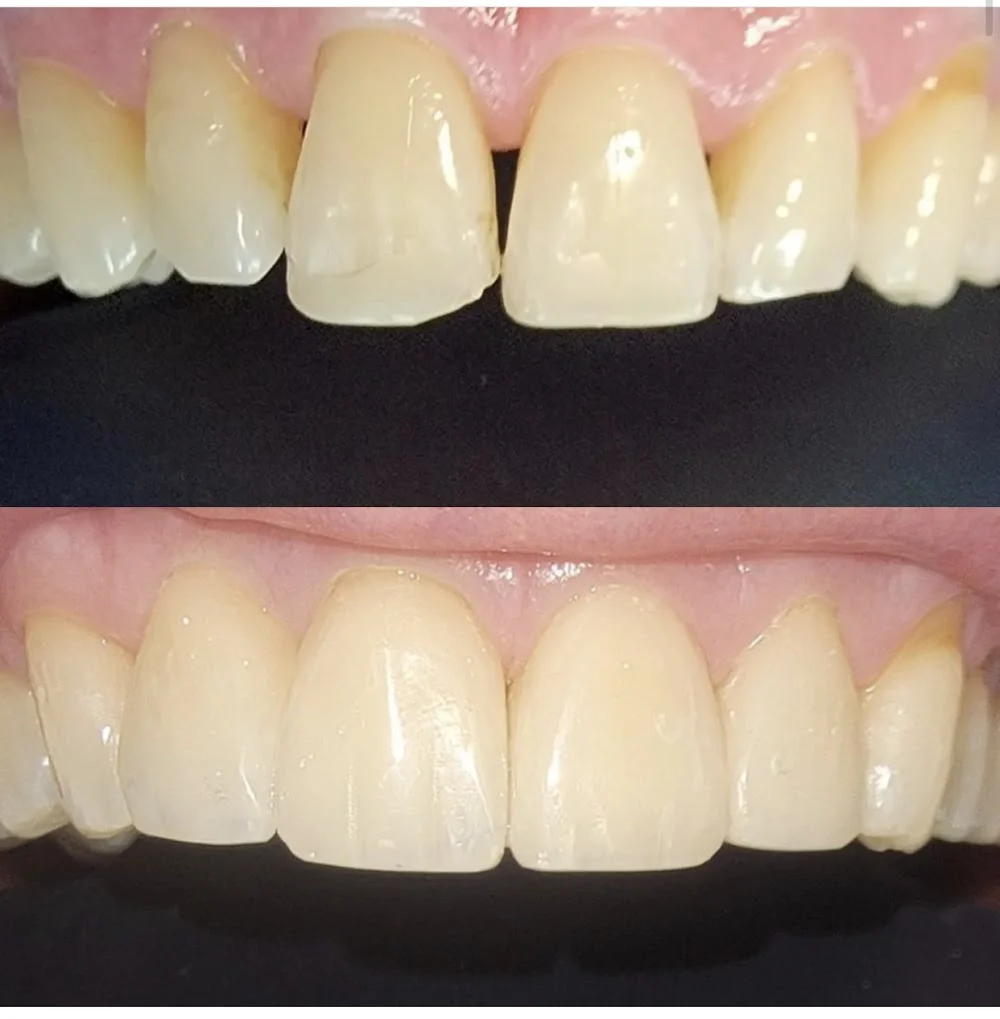 Desert Ridge Smiles - Radhika Rawal DDS Picture 7