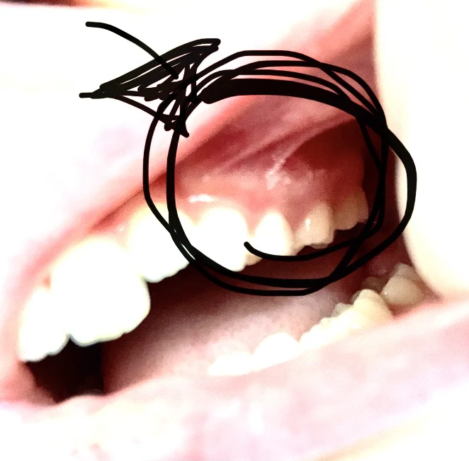 Pediatric Dental Associates Picture 7