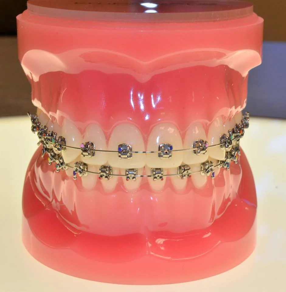 Gig Harbor Orthodontics Picture 4