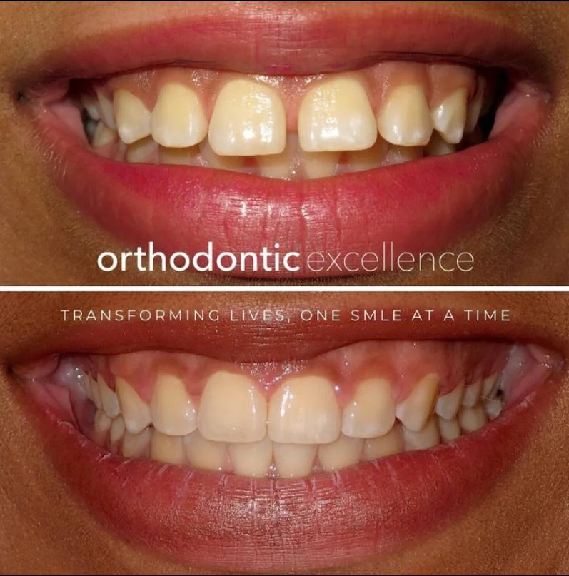 Orthodontic Excellence - Bonney Lake Picture 4