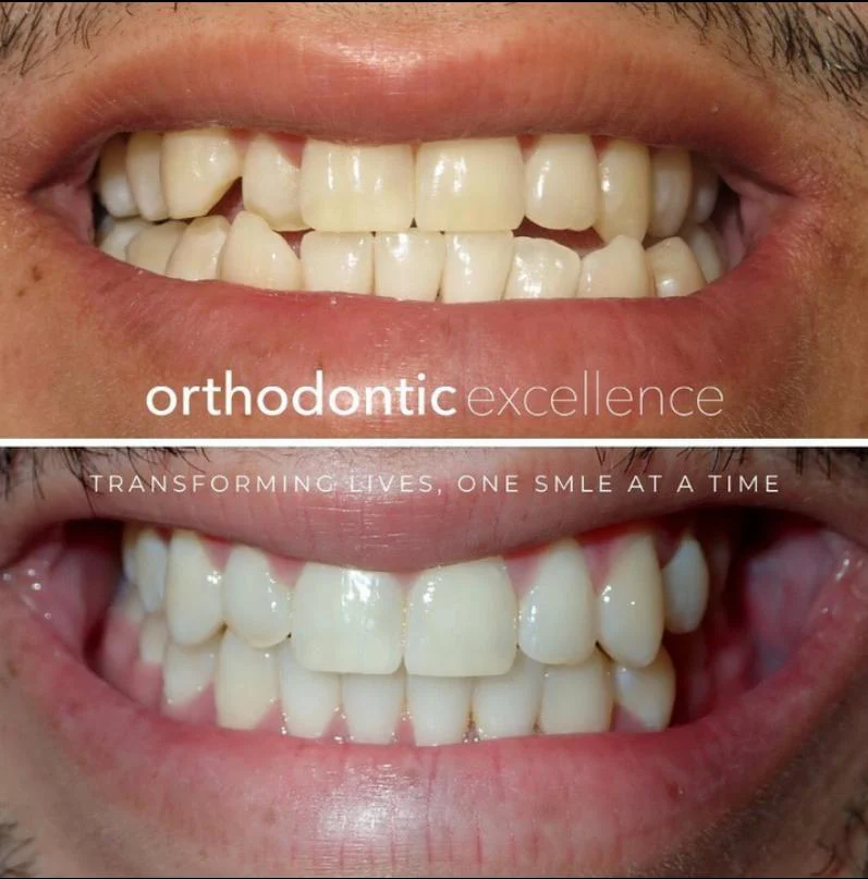 Orthodontic Excellence - Bonney Lake Picture 2