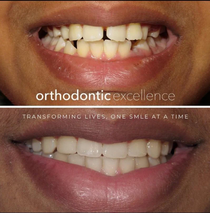 Orthodontic Excellence - Bonney Lake Picture 6