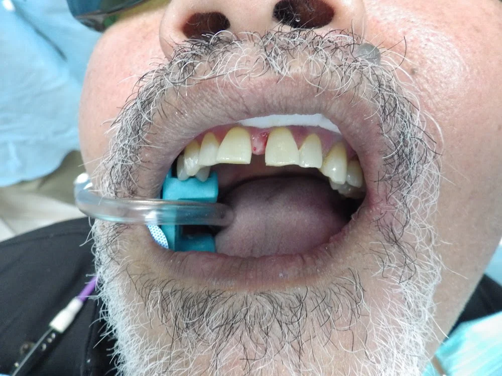 Wonderful Smiles - Puyallup Dentist Picture 9