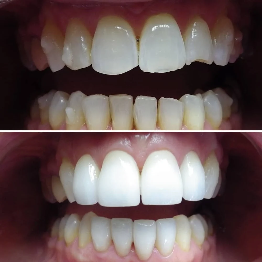 Wonderful Smiles - Puyallup Dentist Picture 1