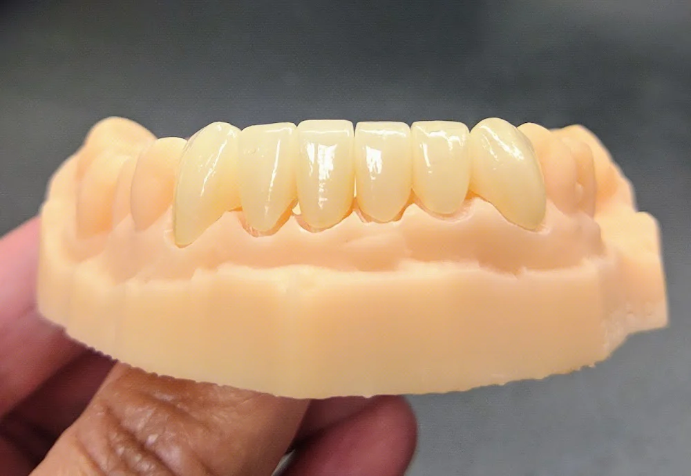 Wonderful Smiles - Puyallup Dentist Picture 6
