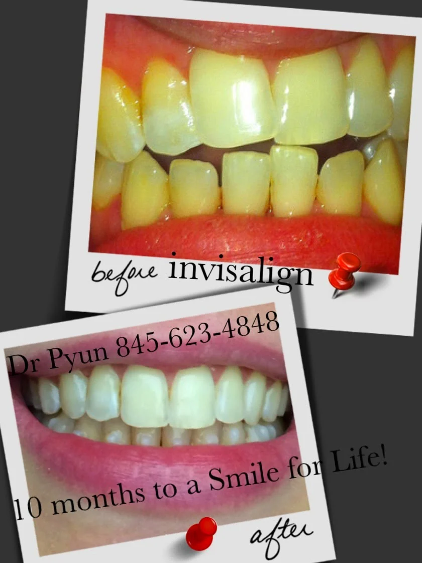 Smile for Life Family & Cosmetic Dental Picture 8
