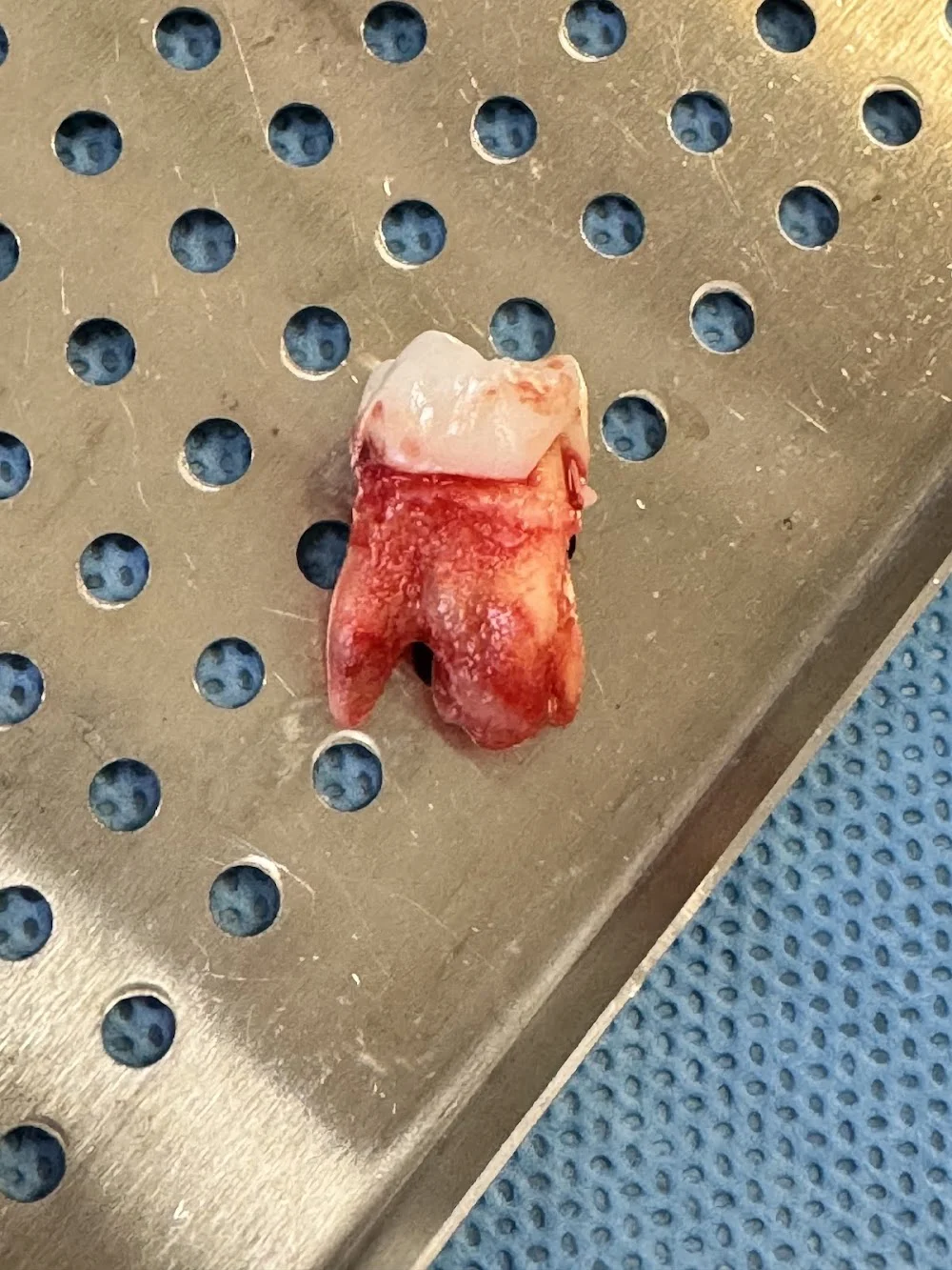 Aspen Dental - Glendale, AZ Picture 6