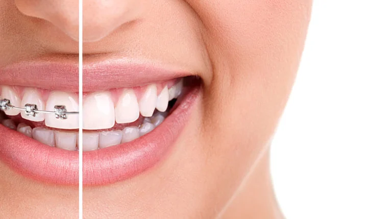 Orthodontist - Dr. Zeynep Ulku Picture 3