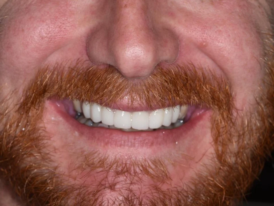 Dr. Ralff Family Dentistry & Implant Center Picture 8