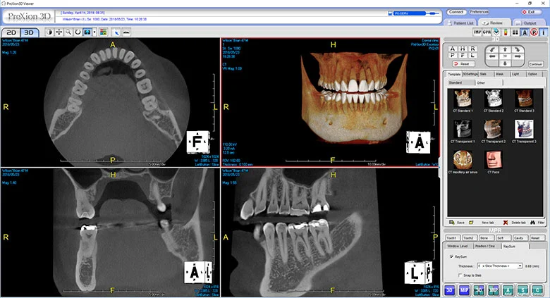 Auburn Dental Care Picture 5