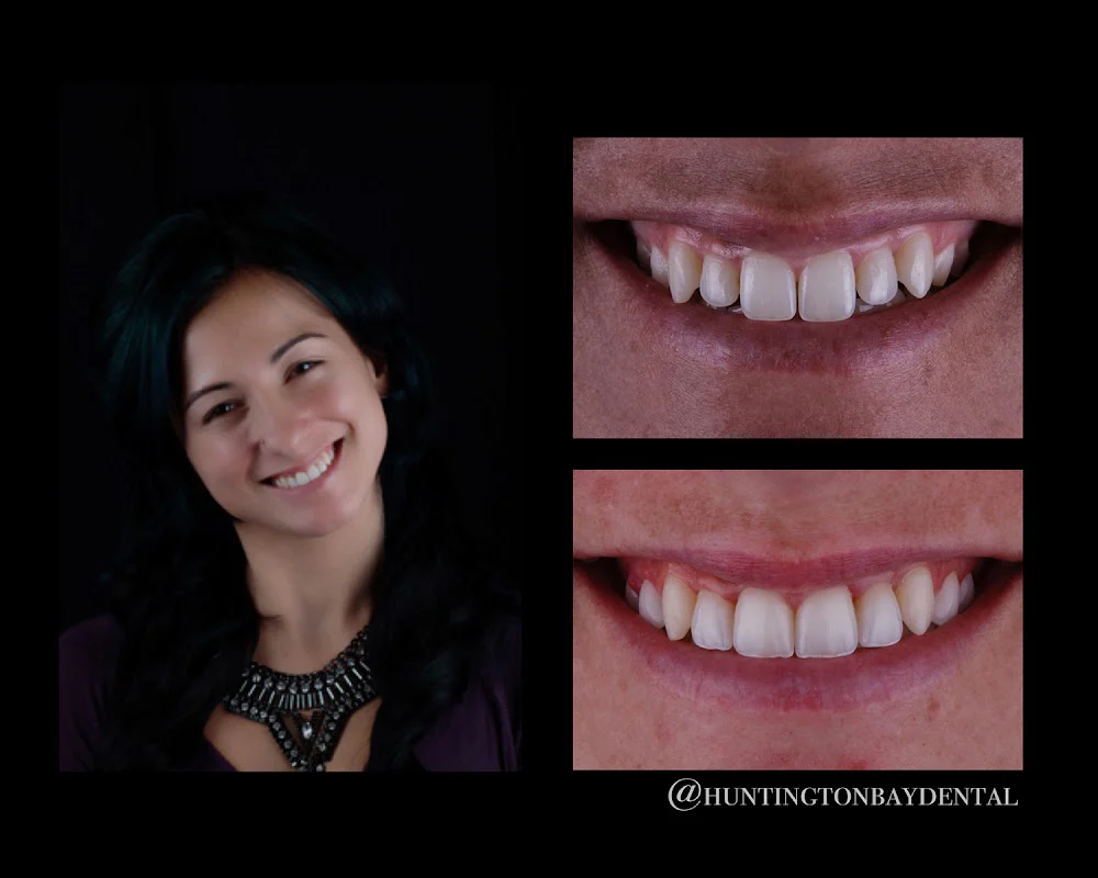 Huntington Bay Dental Picture 8
