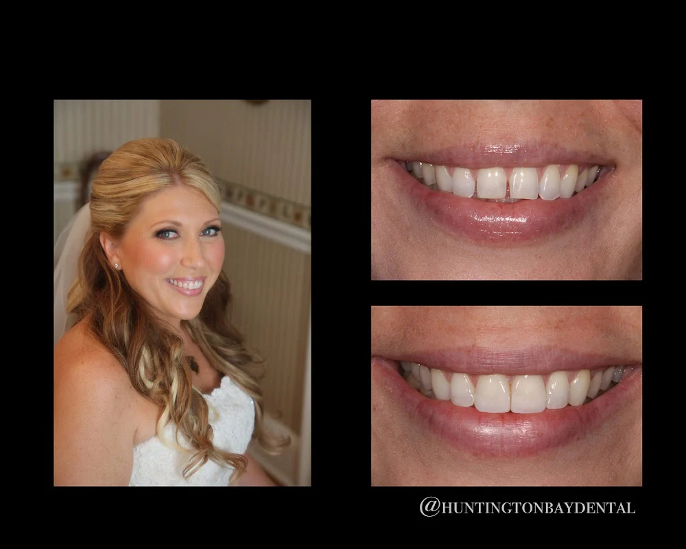 Huntington Bay Dental Picture 7