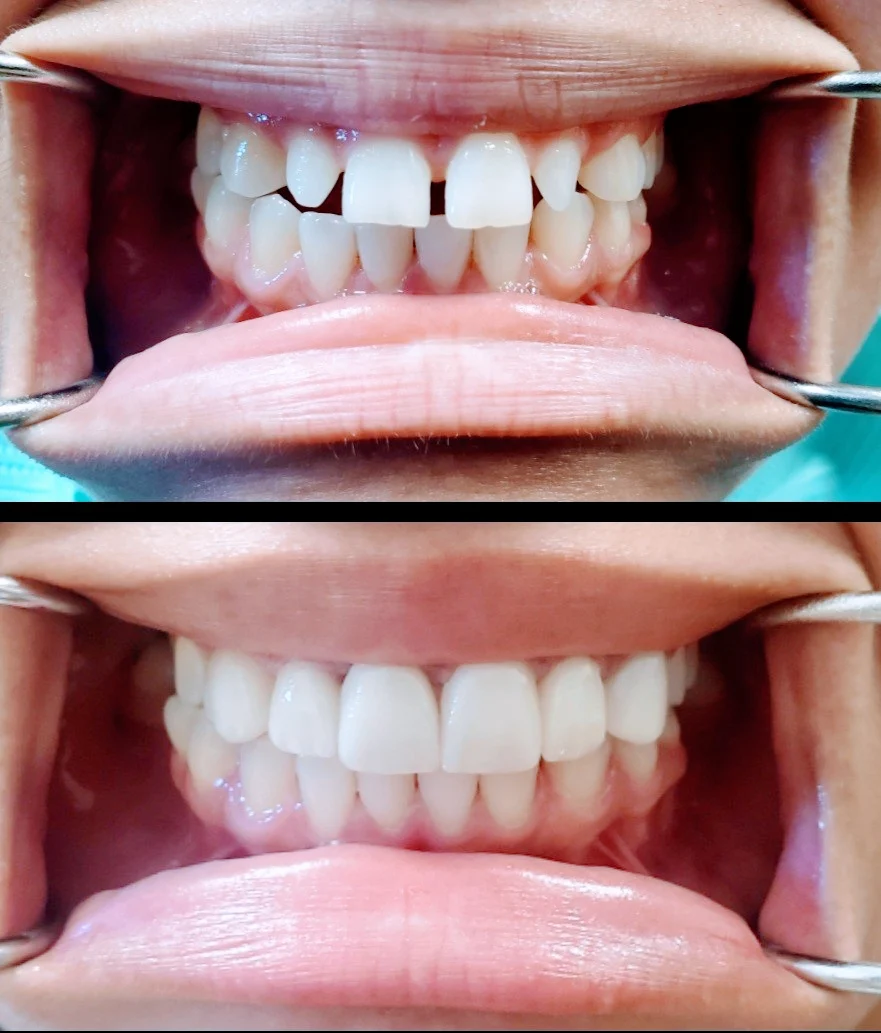 Auburn Dental Smiles Picture 7