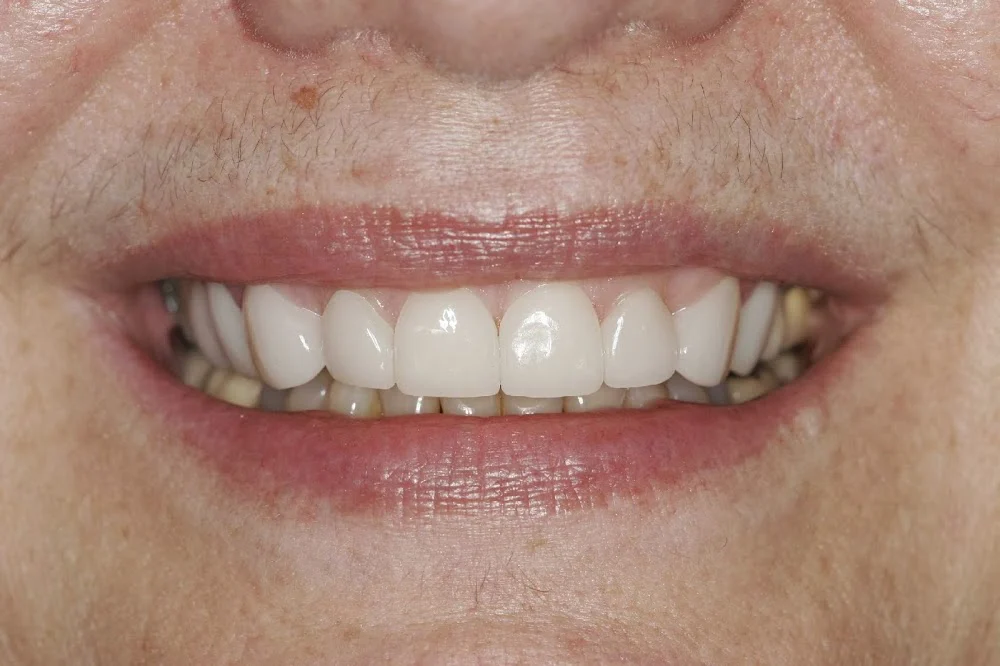 AZ Dentist - Modern Family Dentistry Picture 4