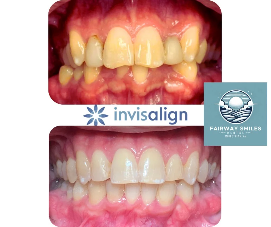 Fairway Smiles Dental Picture 2