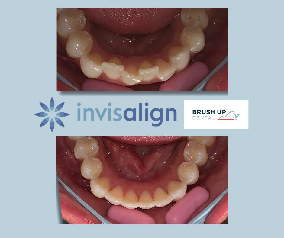 Fairway Smiles Dental Picture 8