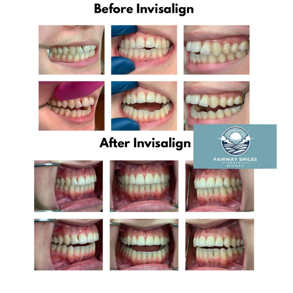 Fairway Smiles Dental Picture 6