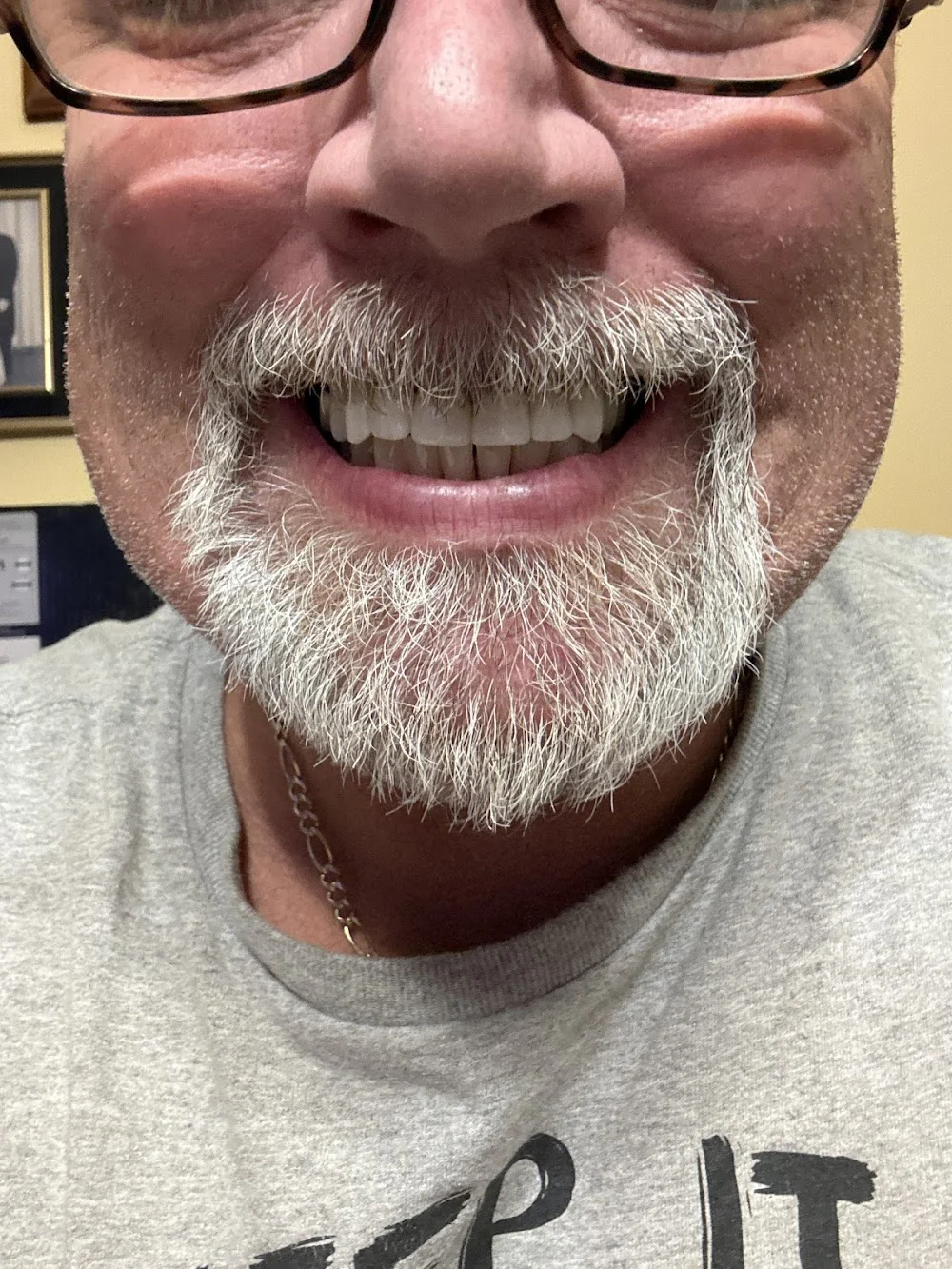 Grand Dental Arts Picture 6