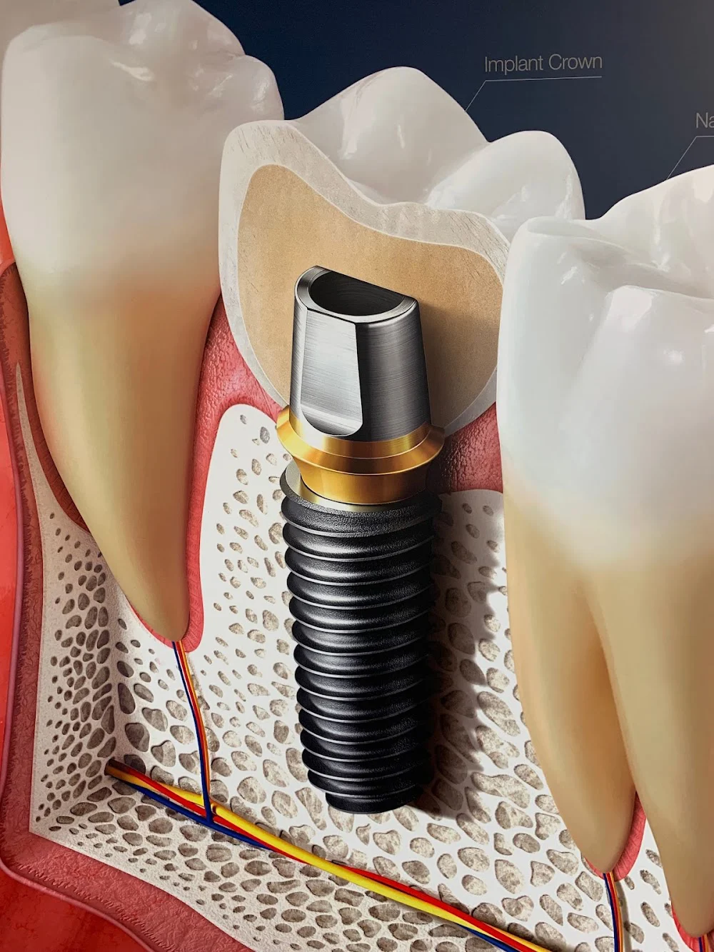 Dental Excellence of Pennsauken Picture 5