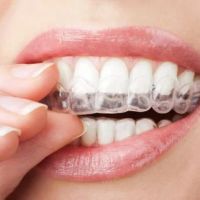 Yang Orthodontics - Invisalign & Braces in Newtown ico