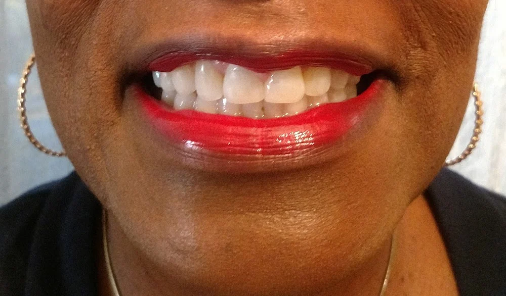 Twin Hickory Dental Picture 7