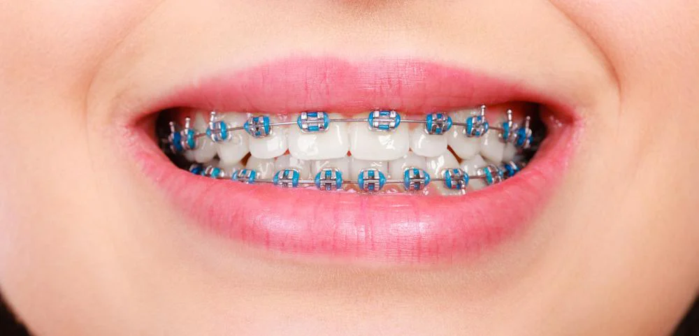 Lakeside Family Dental Picture 7