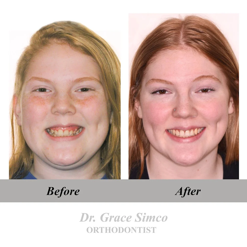 Grace's Braces Picture 7