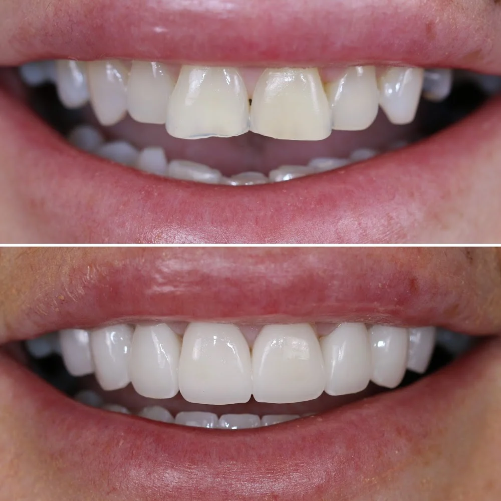 Dentist in Park Ridge, NJ - Enhance Dentistry Picture 5