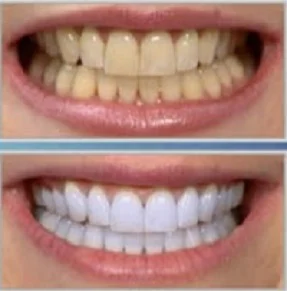Advance Dental Care Picture 4