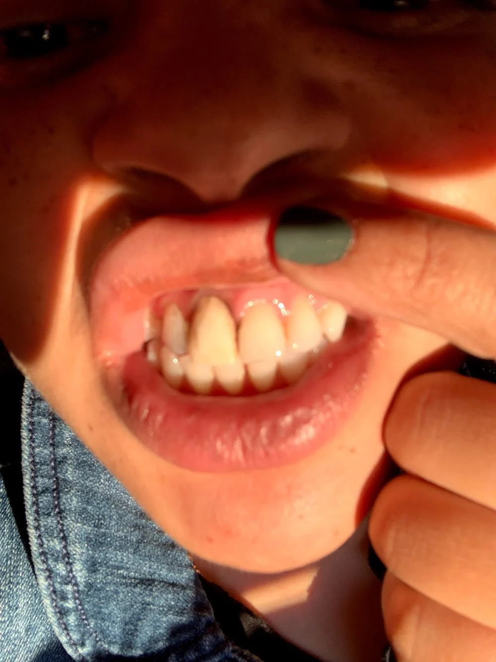Sure Smile Picture 6