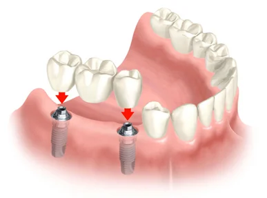 Pennsylvania Center for Advanced Dentistry - Dr. Olga Shvarts Picture 2