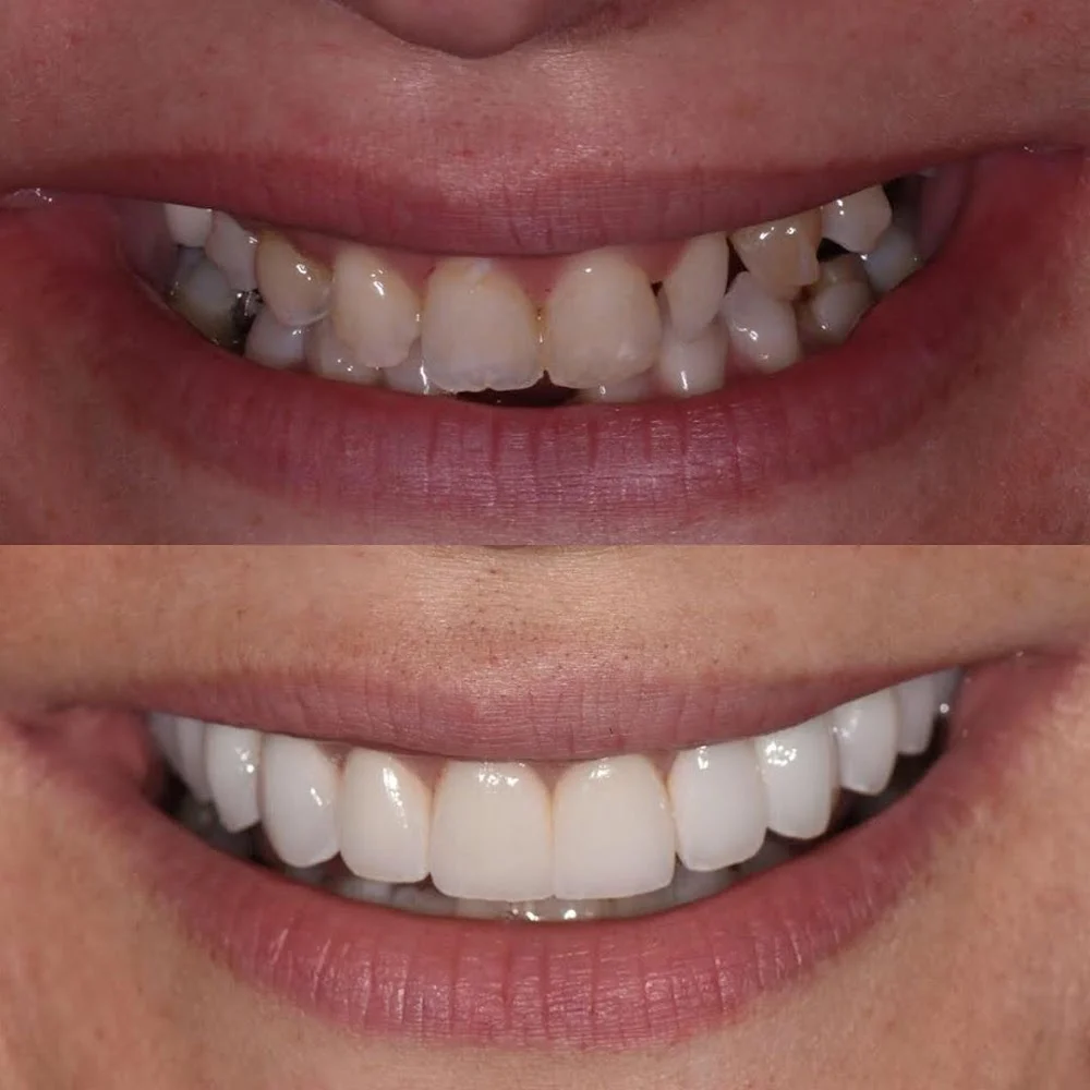 Smile Culture Dental - Trevose Picture 8