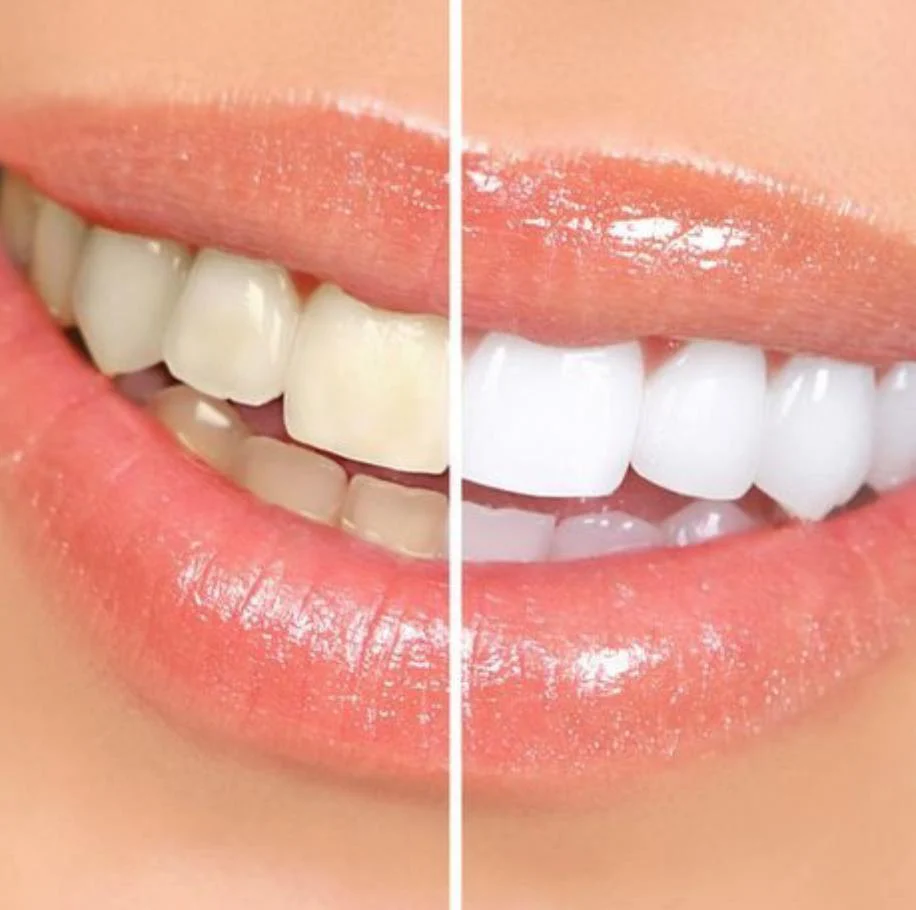 Dr. Dmitry Karagodsky | Smile Maker Picture 10