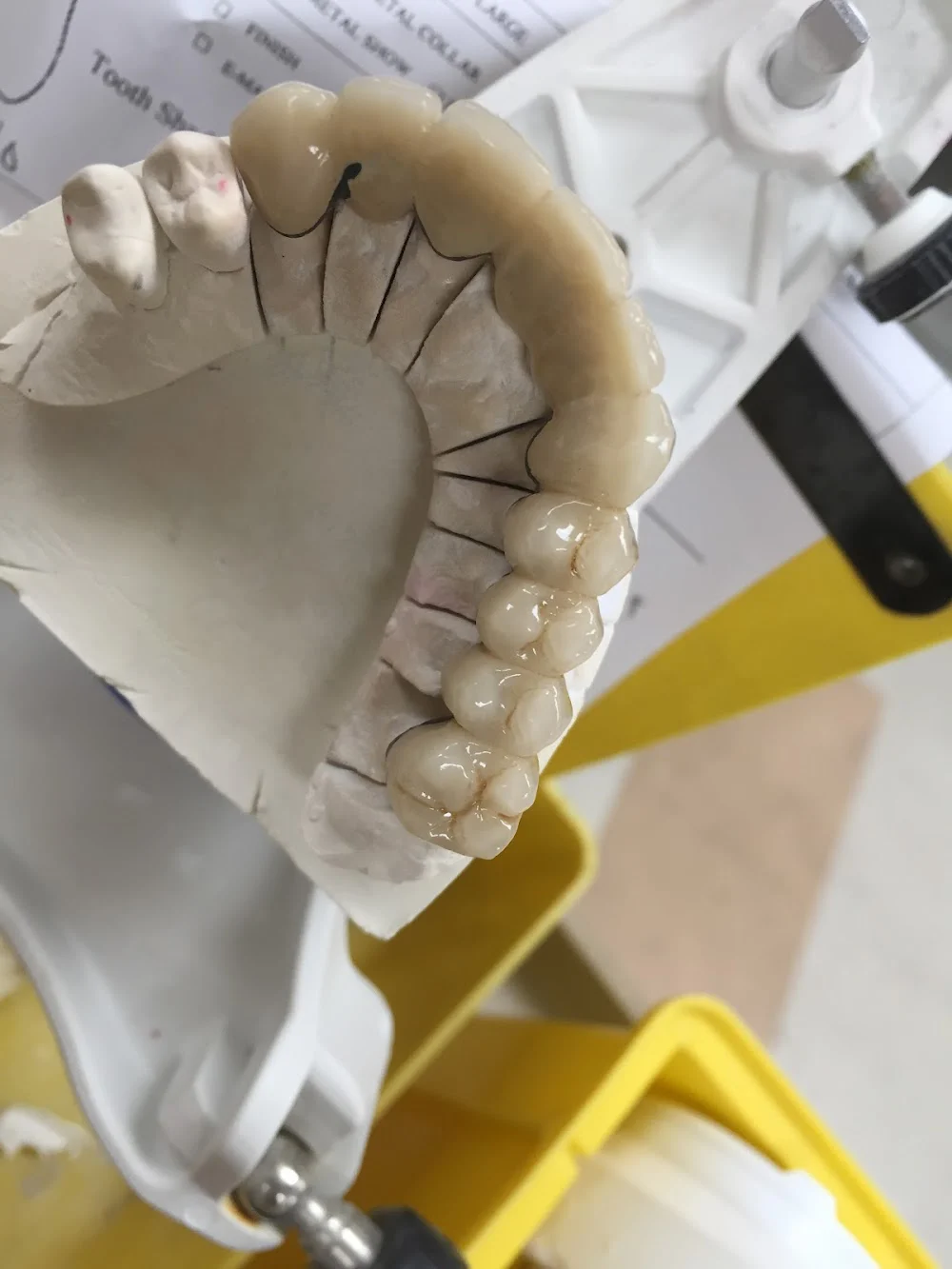 Cosmetic Dental Lab Picture 9