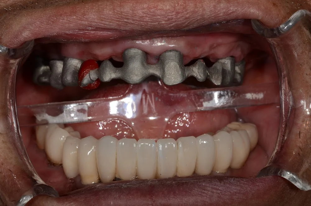 Cosmetic Dental Lab Picture 6