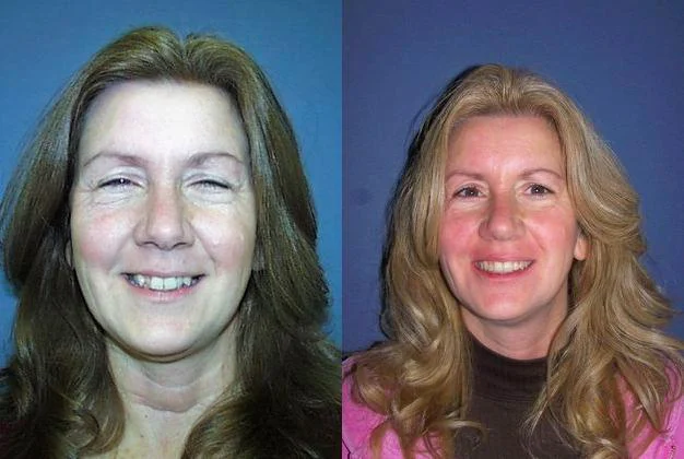 Kellyn Hodges Orthodontics Picture 8