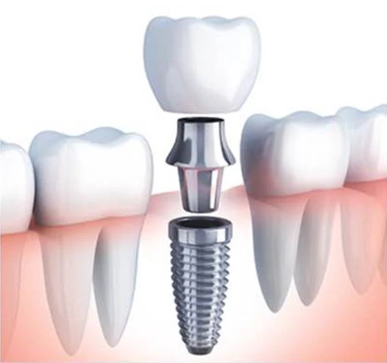 SEARINGTOWN DENTAL P.C. Picture 7