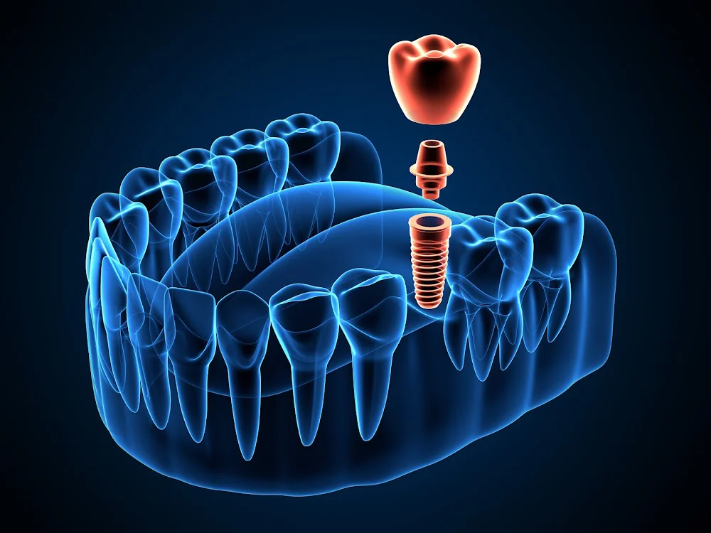 Lane Oral & Maxillofacial Surgery & Dental Implant Center Picture 7