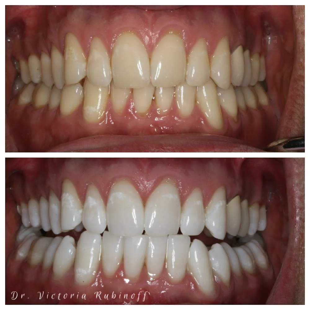 Shine Dental Associates Picture 10