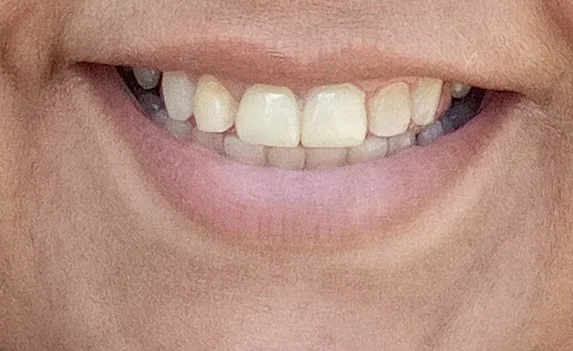 Dental Dreams Picture 1