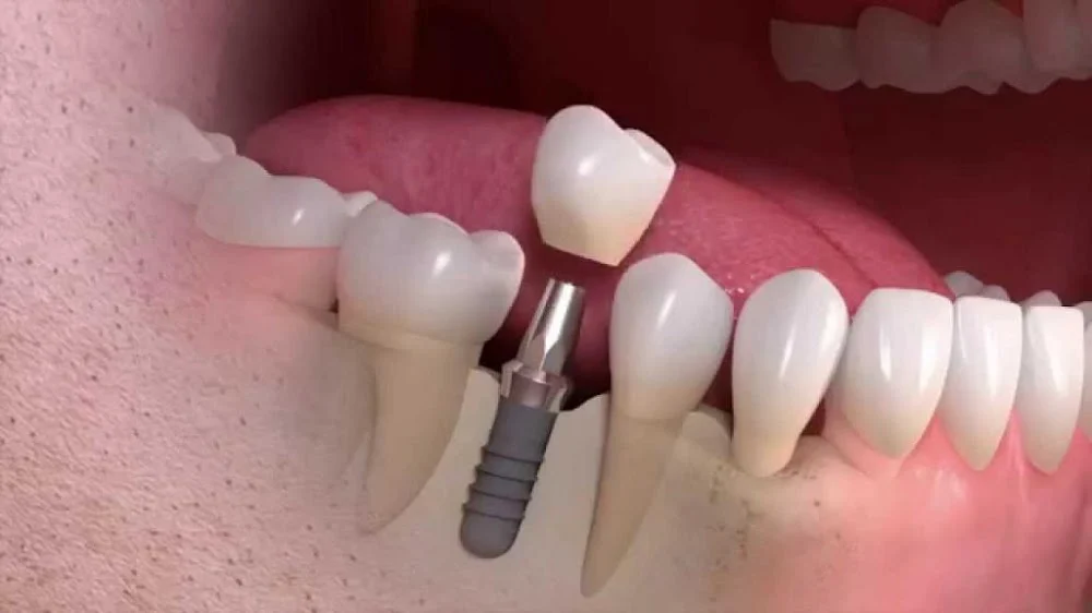 Northeast Periodontal Specialists Picture 10