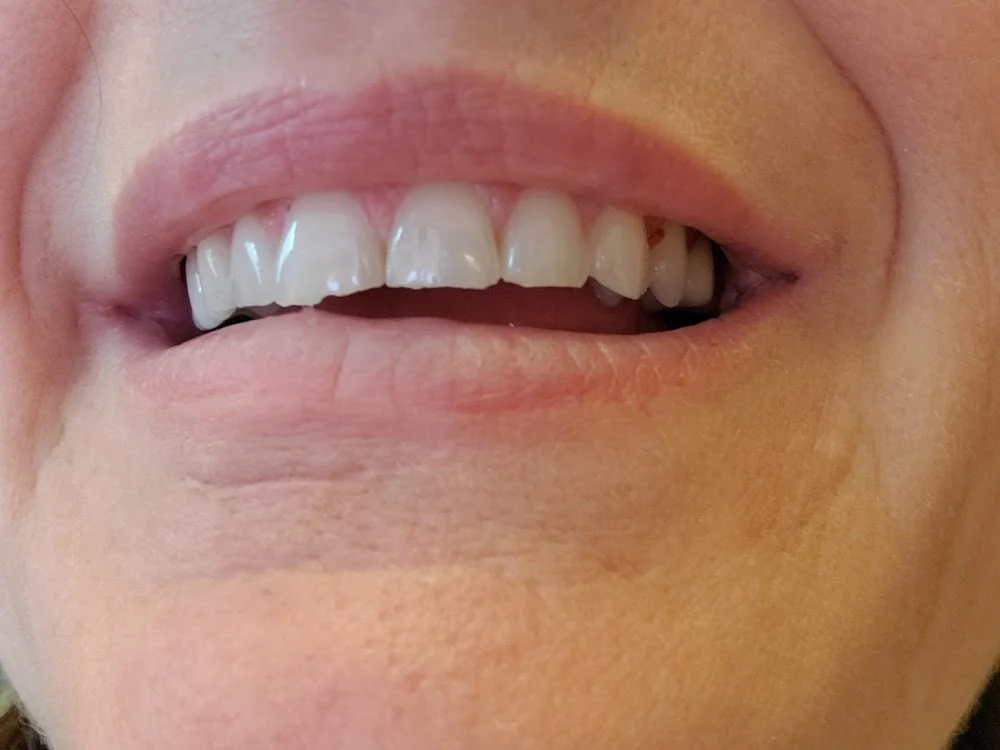 Bright Now! Dental & Orthodontics Picture 2