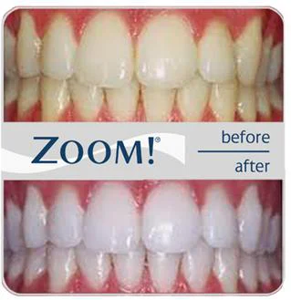 Towne Square Dental Picture 10