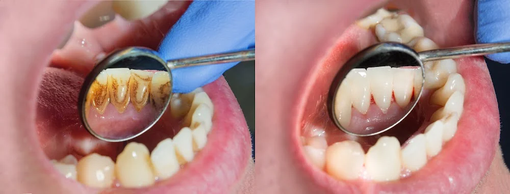 Stites Dental Care Picture 1