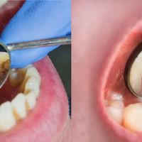Stites Dental Care ico