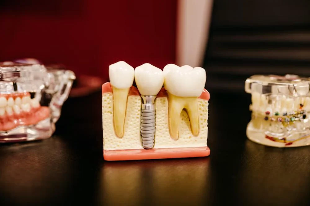 Kimes & Bohl Dental Center Picture 4