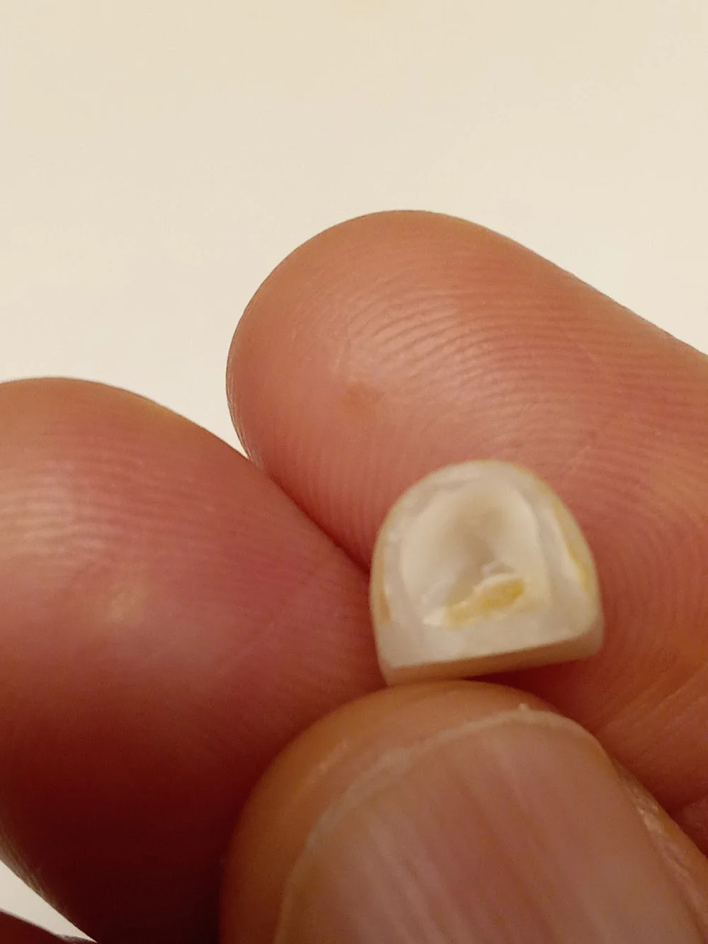 Northwest Dental Health & Aesthetics Picture 10