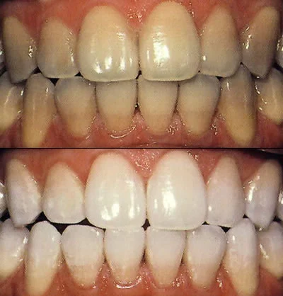 Neu Family Dental Picture 4